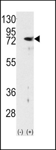 Western blot of PKC delta (arrow) using rabbit polyclonal PKC delta Antibody. 293 cell lysates (2 ug/lane) either nontransfected (Lane 1) or transiently transfected with the PRKCD gene (Lane 2) (Origene Technologies).