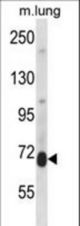 Mouse Prkcd Antibody western blot of mouse lung tissue lysates (35 ug/lane). The Prkcd antibody detected the Prkcd protein (arrow).
