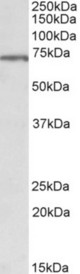 MLC1 antibody (1 ug/ml) staining of Hippocampus lysate (35 ug protein in RIPA buffer). Primary incubation was 1 hour. Detected by chemiluminescence.