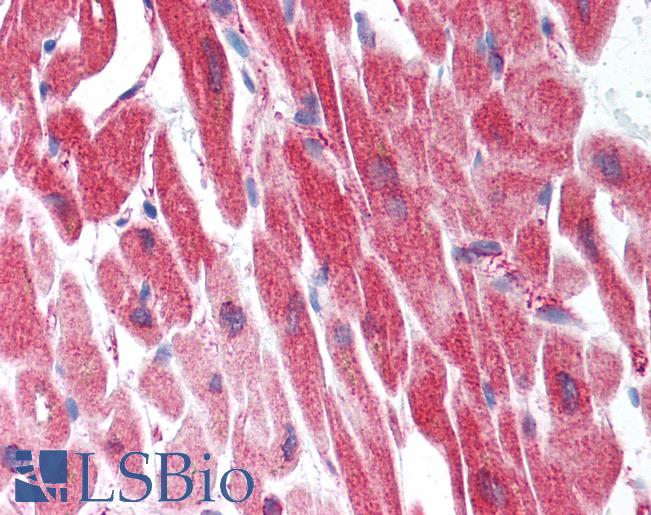 Anti-MYL9 antibody IHC of human heart. Immunohistochemistry of formalin-fixed, paraffin-embedded tissue after heat-induced antigen retrieval. Antibody LS-B1481 concentration 10 ug/ml.
