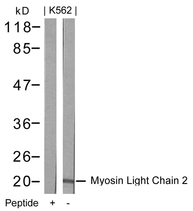 Western blot of extracts from K562 cells using Myosin Light Chain 2(Ab-18) antibody and the same antibody preincubated with blocking peptide.