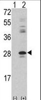 Western blot of PRKCDBP (arrow) using rabbit polyclonal PRKCDBP Antibody. 293 cell lysates (2 ug/lane) either nontransfected (Lane 1) or transiently transfected with the PRKCDBP gene (Lane 2) (Origene Technologies).