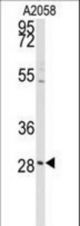 Western blot of anti-PRKCDBP Antibody in A2058 cell line lysates (35 ug/lane). PRKCDBP (arrow) was detected using the purified antibody.