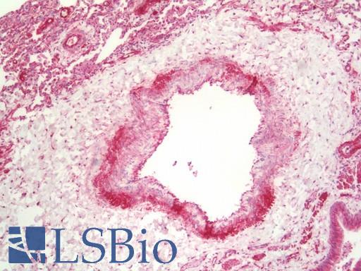 Anti-PRKCDBP / CAVIN3 antibody IHC staining of human lung, endothelium. Immunohistochemistry of formalin-fixed, paraffin-embedded tissue after heat-induced antigen retrieval. Antibody LS-B10191 concentration 10 ug/ml.