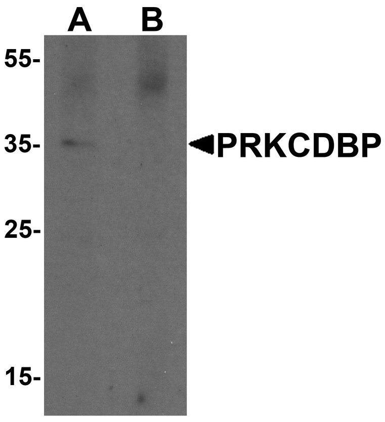 Western blot analysis of PRKCDBP in A20 cell lysate with PRKCDBP antibody at 1 ug/ml in (A) the absence and (B) the presence of blocking peptide.