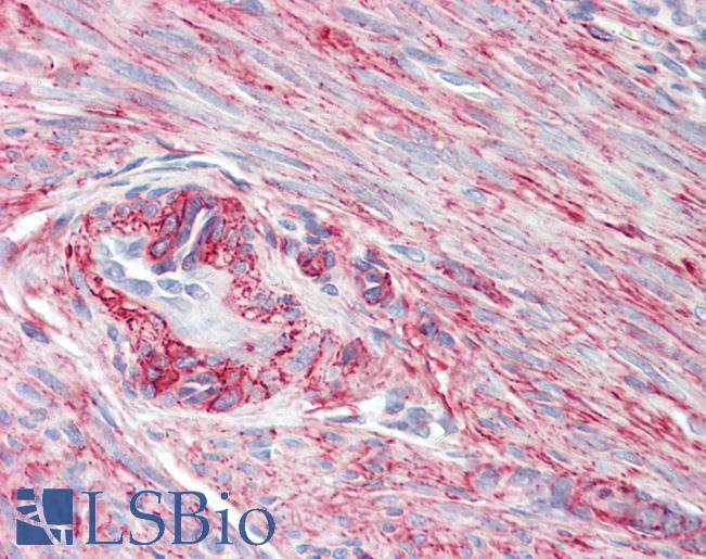 Anti-PRKCDBP / CAVIN3 antibody IHC staining of human uterus, myometrium. Immunohistochemistry of formalin-fixed, paraffin-embedded tissue after heat-induced antigen retrieval.