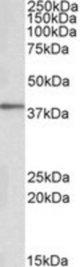 PRKCDBP antibody (0.1 ug/ml) staining of Human Adipose cell lysate (35 ug protein/ml in RIPA buffer). Primary incubation was 1 hour. Detected by chemiluminescence.