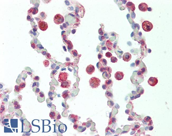 Anti-PRKCDBP / CAVIN3 antibody IHC staining of human lung. Immunohistochemistry of formalin-fixed, paraffin-embedded tissue after heat-induced antigen retrieval. Antibody LS-B10619 concentration 5 ug/ml.