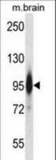 Mouse Prkce Antibody western blot of mouse brain tissue lysates (35 ug/lane). The Prkce antibody detected the Prkce protein (arrow).