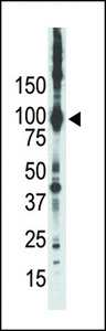 Western blot of anti-PKC epsilon antibody in placenta lysate. PKC epsilon (Arrow) was detected using purified antibody. Secondary HRP-anti-rabbit was used for signal visualization with chemiluminescence.