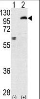 Western blot of PRKCE (arrow) using rabbit polyclonal PKC epsilon Antibody. 293 cell lysates (2 ug/lane) either nontransfected (Lane 1) or transiently transfected with the PRKCE gene (Lane 2) (Origene Technologies).