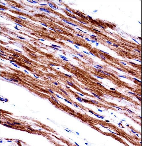 MYL9 Antibody immunohistochemistry of formalin-fixed and paraffin-embedded human heart tissue followed by peroxidase-conjugated secondary antibody and DAB staining.