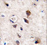 Formalin-fixed and paraffin-embedded human brain tissue reacted with PKC gamma antibody , which was peroxidase-conjugated to the secondary antibody, followed by DAB staining. This data demonstrates the use of this antibody for immunohistochemistry; clinical relevance has not been evaluated.