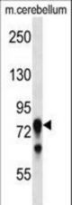 Mouse Prkcg Antibody western blot of mouse cerebellum tissue lysates (35 ug/lane). The Prkcg antibody detected the Prkcg protein (arrow).