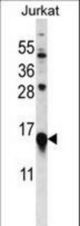 MYL9 Antibody western blot of Jurkat cell line lysates (35 ug/lane). The MYL9 antibody detected the MYL9 protein (arrow).