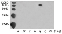 Western blot of recombinant protein of PKC isoforms using Rabbit Anti-PKC eta Polyclonal Antibody,. demonstrating the isoform-specificity of this antibody.