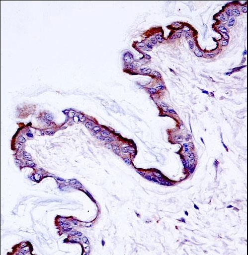 Mouse Prkch Antibody immunohistochemistry of formalin-fixed and paraffin-embedded mouse skin tissue followed by peroxidase-conjugated secondary antibody and DAB staining.