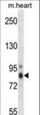 Mouse Prkch Antibody western blot of mouse heart tissue lysates (35 ug/lane). The Prkch antibody detected the Prkch protein (arrow).