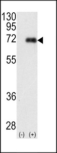 Western blot of PRKCI (arrow) using rabbit polyclonal PKC iota Antibody. 293 cell lysates (2 ug/lane) either nontransfected (Lane 1) or transiently transfected with the PRKCI gene (Lane 2) (Origene Technologies).