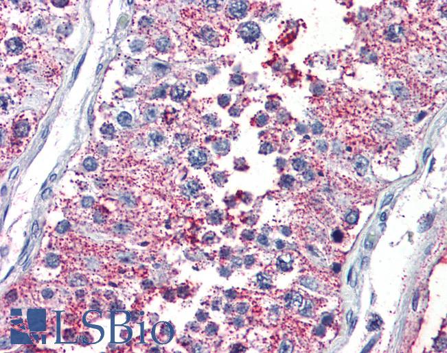Anti-PRKCZ / PKC-Zeta antibody LS-A8391 IHC of human testis. Immunohistochemistry of formalin-fixed, paraffin-embedded tissue after heat-induced antigen retrieval.