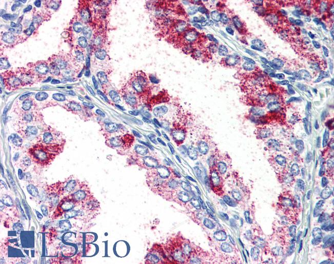 Anti-PRKCZ / PKC-Zeta antibody LS-A8391 IHC of human prostate. Immunohistochemistry of formalin-fixed, paraffin-embedded tissue after heat-induced antigen retrieval.