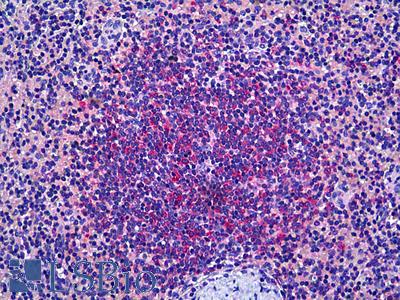 Anti-PRKD2 antibody IHC of human spleen. Immunohistochemistry of formalin-fixed, paraffin-embedded tissue after heat-induced antigen retrieval. Antibody LS-B5453 concentration 10 ug/ml.