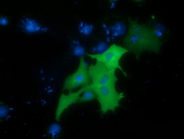 Anti-PRKD2 mouse monoclonal antibody immunofluorescent staining of COS7 cells transiently transfected by pCMV6-ENTRY PRKD2.