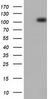 HEK293T cells were transfected with the pCMV6-ENTRY control (Left lane) or pCMV6-ENTRY PRKD2 (Right lane) cDNA for 48 hrs and lysed. Equivalent amounts of cell lysates (5 ug per lane) were separated by SDS-PAGE and immunoblotted with anti-PRKD2.