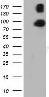 HEK293T cells were transfected with the pCMV6-ENTRY control (Left lane) or pCMV6-ENTRY PRKD2 (Right lane) cDNA for 48 hrs and lysed. Equivalent amounts of cell lysates (5 ug per lane) were separated by SDS-PAGE and immunoblotted with anti-PRKD2.