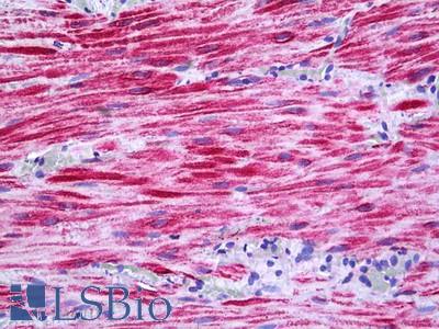 Anti-PRKD2 antibody IHC of human intestine. Immunohistochemistry of formalin-fixed, paraffin-embedded tissue after heat-induced antigen retrieval. Antibody LS-B5654 concentration 10 ug/ml.