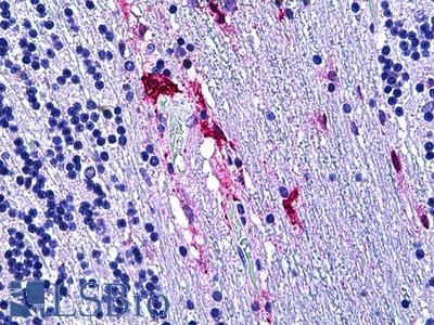 Anti-PRKD2 antibody IHC of human brain cerebellum. Immunohistochemistry of formalin-fixed, paraffin-embedded tissue after heat-induced antigen retrieval. Antibody LS-B5654 concentration 10 ug/ml.