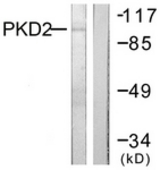 Western blot of extracts from NIH-3T3 cells, treated with PMA 250 ng/ml 15', using PKD2 Antibody. The lane on the right is treated with the synthesized peptide.