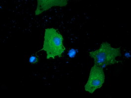 Anti-PRKD2 mouse monoclonal antibody immunofluorescent staining of COS7 cells transiently transfected by pCMV6-ENTRY PRKD2.