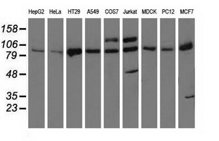 Western blot of extracts (35 ug) from 9 different cell lines by using anti-PRKD2 monoclonal antibody.