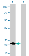 Western blot of MYL1 expression in transfected 293T cell line by MYL1 monoclonal antibody (M01), clone 2D9.