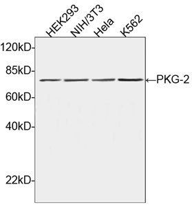 Western blot of cell lysates, using PKG-2 Antibody, pAb, Rabbit. The signal was developed with Goat Anti-Rabbit IgG (H&L) [HRP] Polyclonal Antibody. Predicted Size: 78 kD. Observed Size: 78 kD.