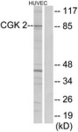 Western blot of extracts from HUVEC cells, using CGK 2 Antibody. The lane on the right is treated with the synthesized peptide.
