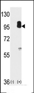 Western blot of cGKII (arrow) using cGKII Antibody. 293 cell lysates (2 ug/lane) either nontransfected (Lane 1) or transiently transfected with the PRKG2 gene (Lane 2).