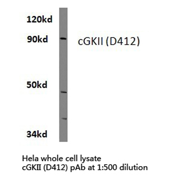 Western blot of cGKii (D412) pAb in extracts from HeLa cells.