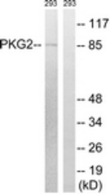 Western blot of extracts from 293 cells, treated with anisomycin 25ug/ml 30', using PKG2 Antibody. The lane on the right was incubated with synthetic peptide.