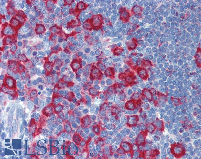 Anti-PRKRA / PACT antibody IHC of human tonsil. Immunohistochemistry of formalin-fixed, paraffin-embedded tissue after heat-induced antigen retrieval. Antibody LS-B5704 concentration 5 ug/ml.
