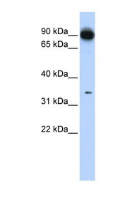 PRKRA / PACT antibody LS-B5704 Western blot of Fetal Lung lysate.