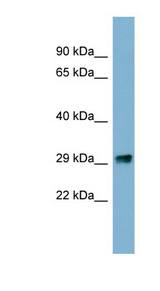 PRKRIP1 antibody LS-C107664 Western blot of COLO205 cell lysate.