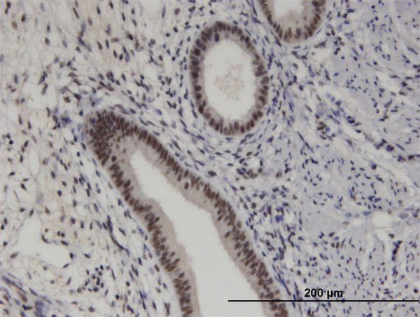 Immunoperoxidase of monoclonal antibody to PRKRIP1 on formalin-fixed paraffin-embedded human endometrium. [antibody concentration 5 ug/ml]