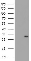HEK293T cells were transfected with the pCMV6-ENTRY control (Left lane) or pCMV6-ENTRY MLF1 (Right lane) cDNA for 48 hrs and lysed. Equivalent amounts of cell lysates (5 ug per lane) were separated by SDS-PAGE and immunoblotted with anti-MLF1.