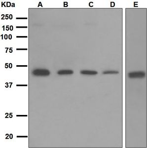Western blot analysis on (A) A549, (B) Jurkat, (C) 293T, (D) fetal kidney, and (E) fetal brain lysates using anti-PRKX antibody.