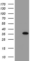 HEK293T cells were transfected with the pCMV6-ENTRY control (Left lane) or pCMV6-ENTRY MLF1 (Right lane) cDNA for 48 hrs and lysed. Equivalent amounts of cell lysates (5 ug per lane) were separated by SDS-PAGE and immunoblotted with anti-MLF1.