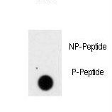 Dot blot of PRL Antibody (S207) antibody on nitrocellulose membrane. 50ng of Phospho-peptide or Non Phospho-peptide per dot were adsorbed. Antibody working concentrations are 0.5ug per ml.
