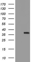 HEK293T cells were transfected with the pCMV6-ENTRY control (Left lane) or pCMV6-ENTRY MLF1 (Right lane) cDNA for 48 hrs and lysed. Equivalent amounts of cell lysates (5 ug per lane) were separated by SDS-PAGE and immunoblotted with anti-MLF1.