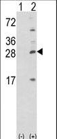 Western blot of PRL (arrow) using rabbit polyclonal PRL-S163.control. 293 cell lysates (2 ug/lane) either nontransfected (Lane 1) or transiently transfected with the PRL gene (Lane 2).